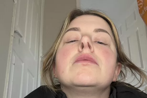 Mum 'devastated' after nose job says 'I'll never go to Turkey again'
