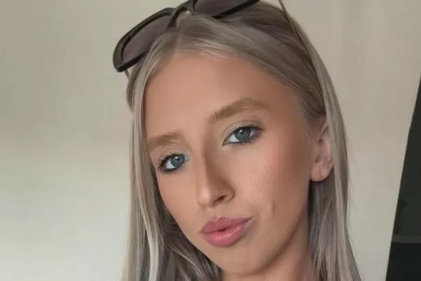 I was attacked by a dog - I looked in the mirror and saw half my face had gone
