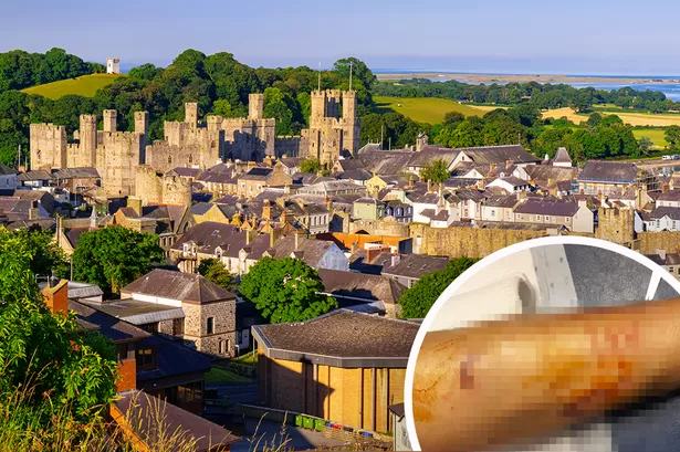 Man mauled by dogs at Welsh beauty spot