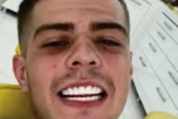 The 'Turkey teeth' selfie that helped police bring drug dealer down